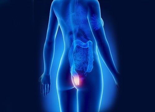 Traitement des hémorroïdes pour vivre mieux