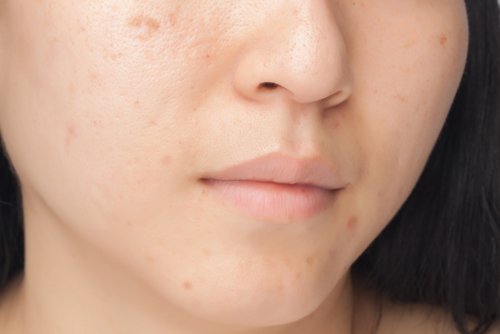 habitudes-abiment-visage-500x334
