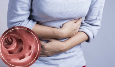 Découvrez comment lutter naturellement contre la diverticulite