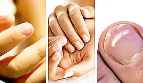 5 Signes De Mauvaise Santé Visibles Sur Les Ongles