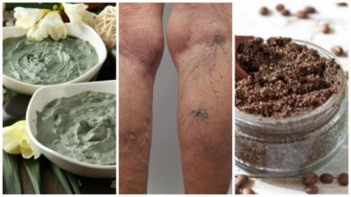 6 remèdes maison pour éliminer les varices