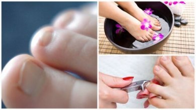 7 choses à savoir sur les mycoses des ongles