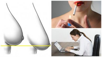 7 mauvaises habitudes favorisant la ptôse mammaire