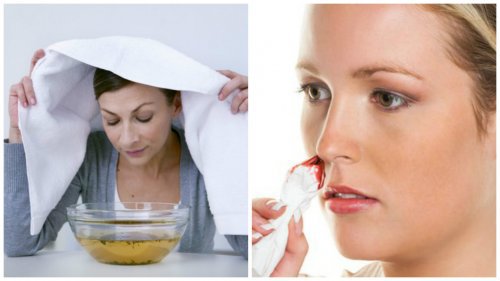 7 solutions maison efficaces contre les saignements de nez