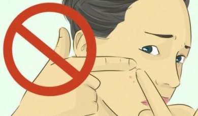 Pourquoi ne faut-il pas percer ses boutons d'acné ?