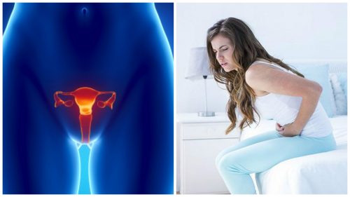 7 données importantes à connaître sur le cancer de l’ovaire 7 données importantes à connaître sur le cancer de l’ovaire