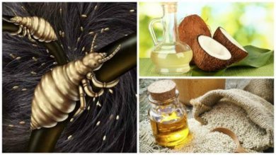 Combattre les poux de manière efficace avec ces 5 remèdes maison