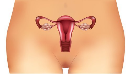 Les symptômes méconnus du syndrome des ovaires polykystiques