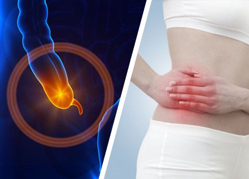 Un appendice enflammé : 7 symptômes