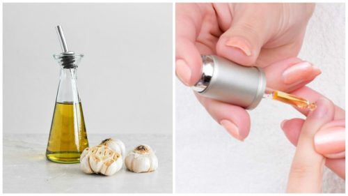 Comment préparer une lotion aux huiles et à l'ail pour fortifier les ongles