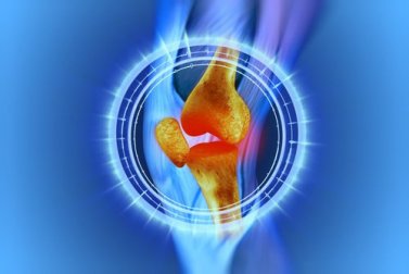 Douleur au genou : 4 choses à faire et 3 choses à éviter