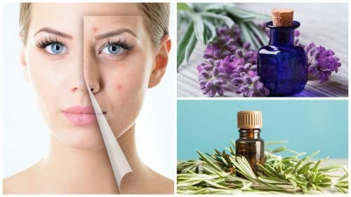 Nettoyez votre visage de l'acné avec ces 6 merveilleuses huiles essentielles