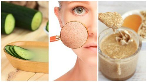 Scellez les pores dilatés de votre peau avec ces 5 remèdes naturels