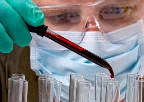 Un simple test sanguin pourrait permettre de localiser les tumeurs
