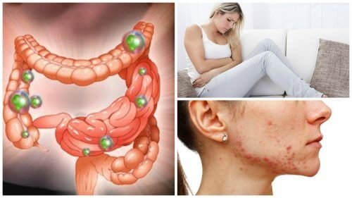 6 problèmes lorsque vos bactéries intestinales sont hors de contrôle