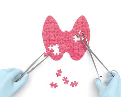 16 signes qui montrent que vous souffrez de l'hypothyroïdie
