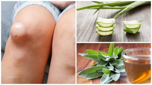 Les 5 meilleurs remèdes anti-inflammatoires pour éliminer le gonflement du genou