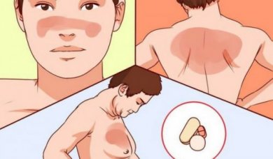 Tout ce que vous devriez savoir sur le lupus