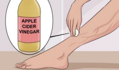 Contre les varices : l'aloe vera, la carotte et le vinaigre de pomme