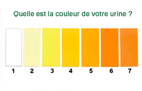 Différentes couleurs de votre urine.