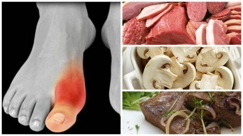 Vous souffrez de goutte ? Voici les 8 aliments que vous devez éviter