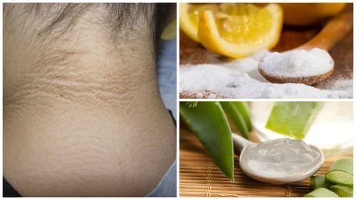 5 traitements pour éclaircir la peau sombre du cou