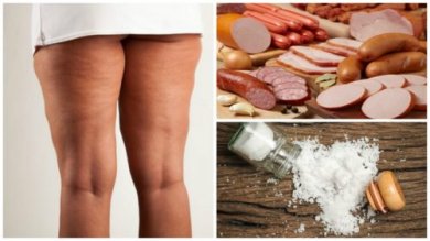 7 aliments à éviter en cas de cellulite