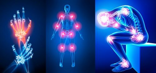 7 raisons pour lesquelles vos articulations vous font souffrir 7 raisons pour lesquelles vos articulations vous font souffrir