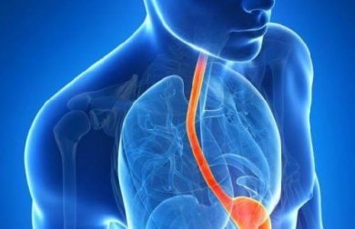 Reflux gastro-œsophagien : 10 symptômes rares