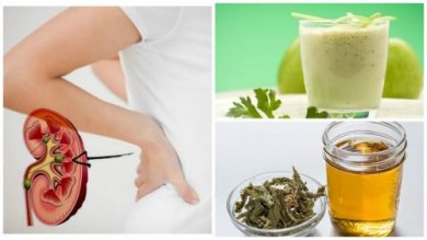 Combattre les calculs rénaux avec 5 remèdes naturels