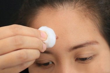 6 problèmes internes que les boutons sur le visage nous indiquent