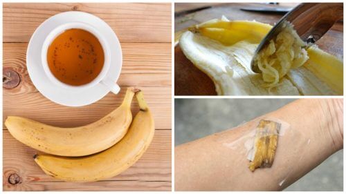 5 façons d'utiliser les peaux de banane comme remède naturel