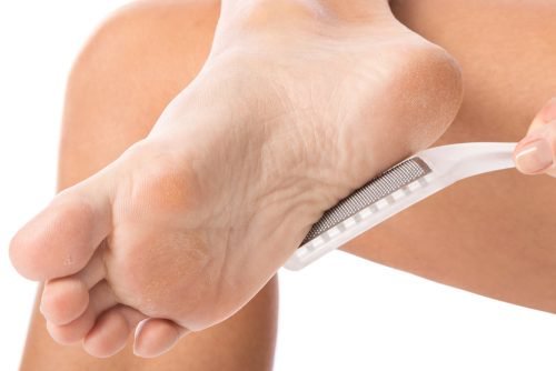 Comment enlever naturellement les cors aux pieds