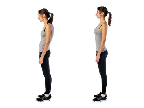 comment améliorer la posture