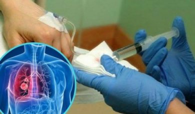 Un médicament pour réduire la chimiothérapie des poumons