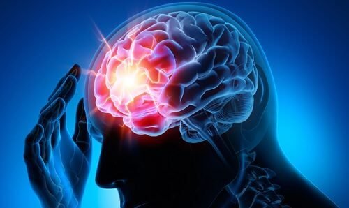 7 astuces pour prévenir un anévrisme