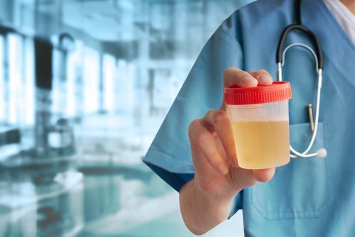 altérations de l'urine