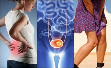 7 signes de cancer de la vessie que l'on ne doit pas ignorer