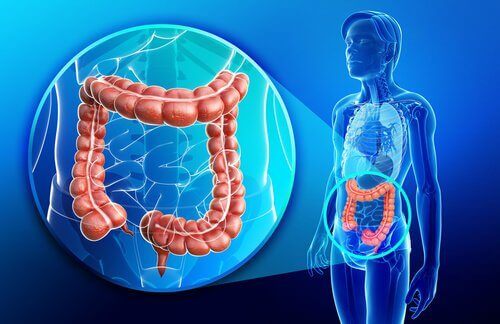 Qu’est-ce que la maladie de Crohn ? Qu’est-ce que la maladie de Crohn ?