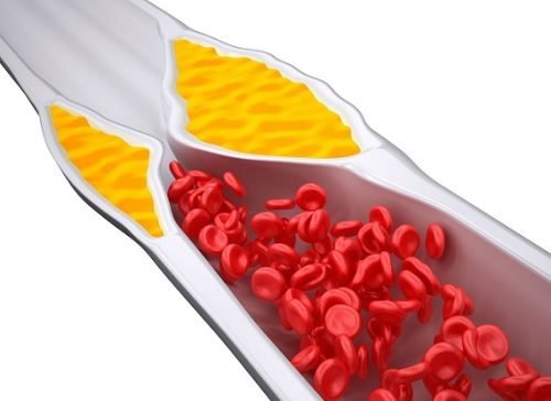 4 smoothies pour contrôler le cholestérol