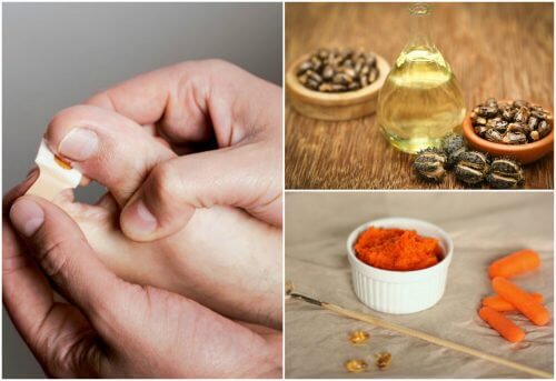 8 traitements pour éliminez les envies ongulaires