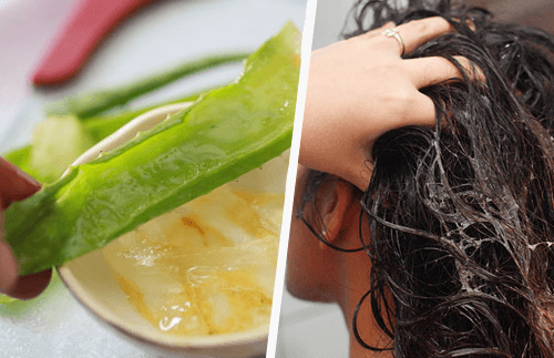 aloe vera pour traiter la calvitie