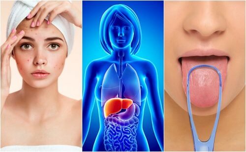 7 signes qui vous alertent sur une intoxication du foie