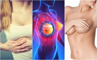 Les 9 symptômes du cancer du sein que toutes les femmes doivent connaître