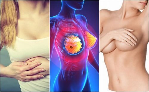 Les-9-symptomes-du-cancer-du-sein-que-toutes-les-femmes-doivent-connaitre-500x309 les symptômes du cancer du sein