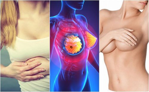 Les 9 symptômes du cancer du sein que toutes les femmes doivent connaître