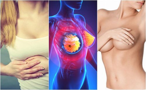 Les 9 symptômes du cancer du sein que toutes les femmes doivent connaître