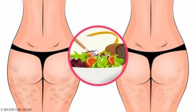 Comment éliminer la cellulite grâce à une alimentation saine
