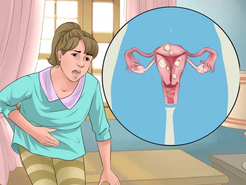 Remèdes naturels pour traiter différents troubles menstruels