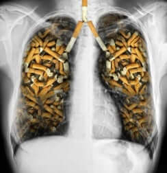 cigarettes dans des poumons